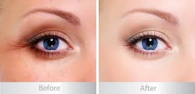 SkinClinic Eyes Peptides - Belle Lab 
